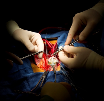 Minimally invasive aortic valve replacement surgery