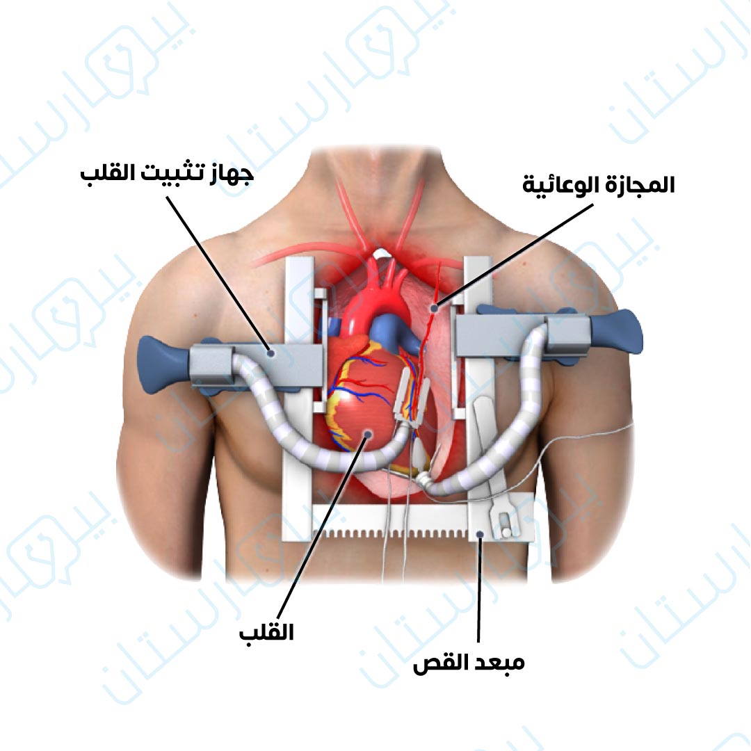 Coronary artery bypass surgery without a pump