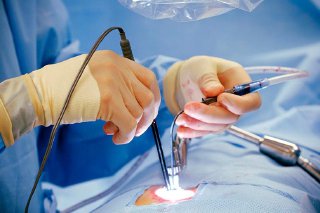 Türkiye'de bir doktor laparoskopik kalp ameliyatı yapıyor