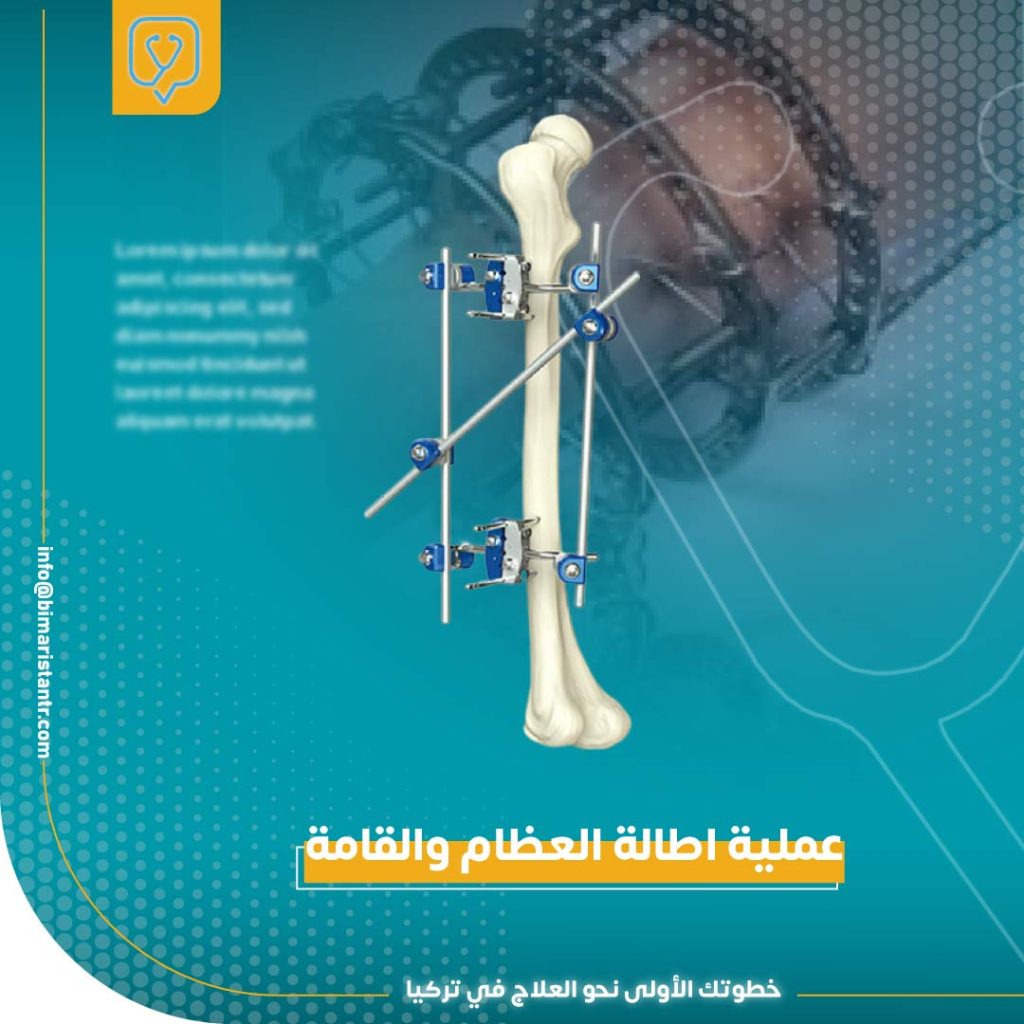 The process of lengthening the bones and stature in Turkey