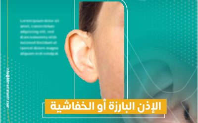 علاج الأذن الخفاشية بدون جراحة – تجميل الأذن البارزة