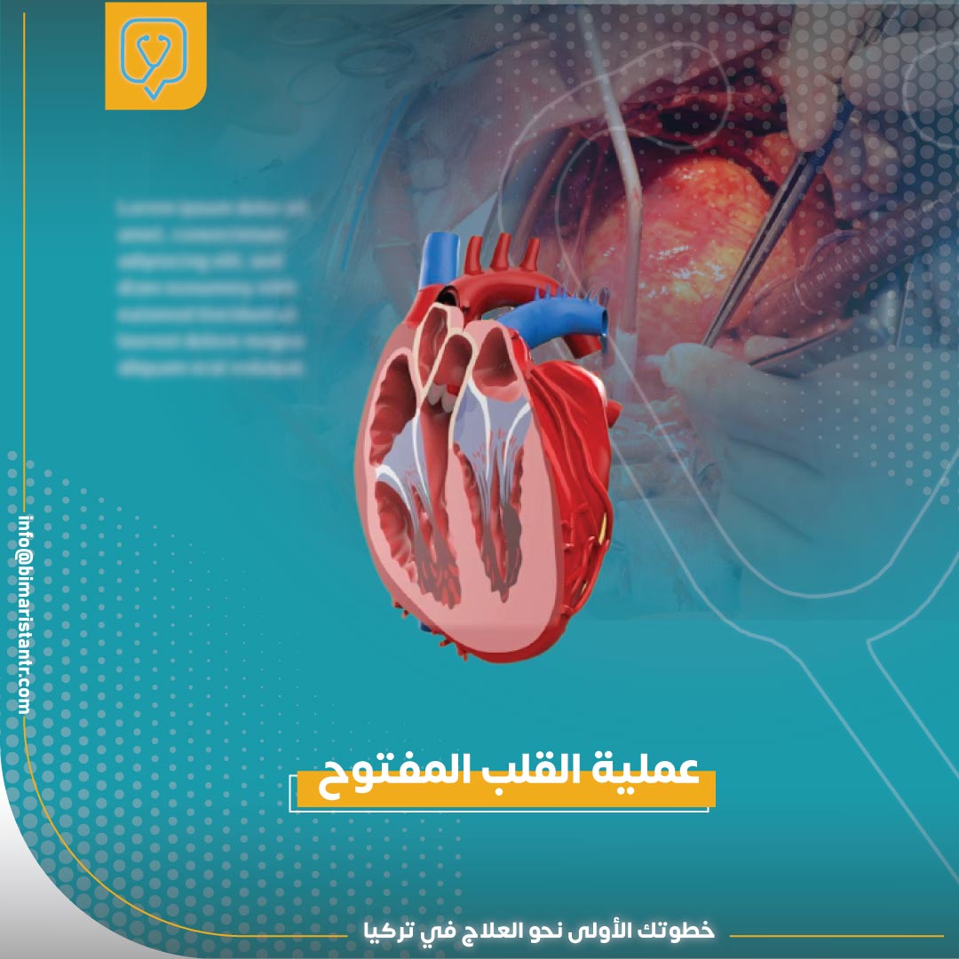 Open-heart operation