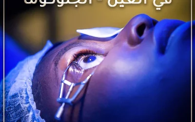 عملية علاج المياه الزرقاء في العين – الجلوكوما
