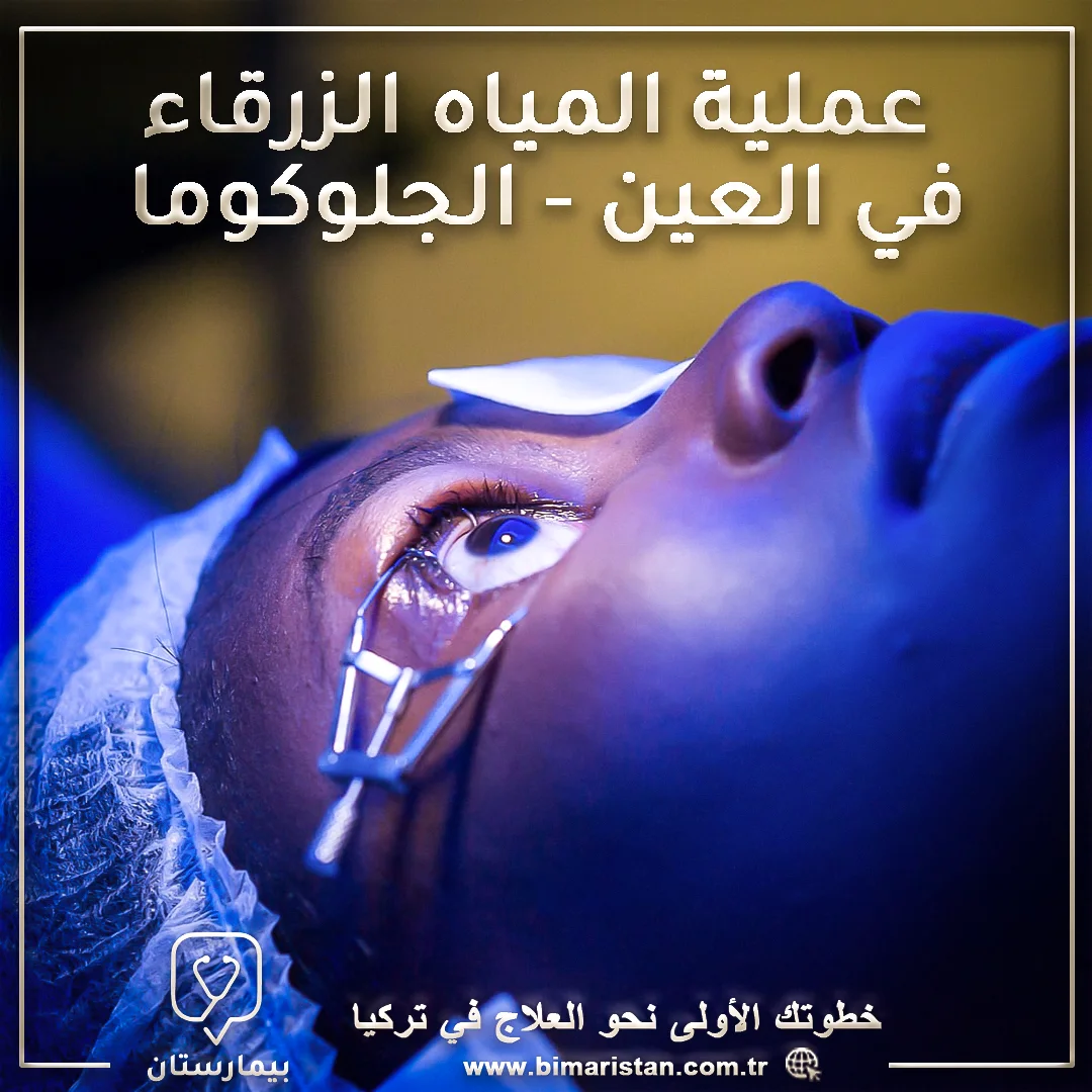 عملية علاج المياه الزرقاء في العين في تركيا - الجلوكوما