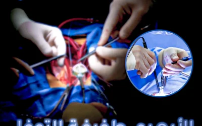 Minimally invasive aortic valve replacement