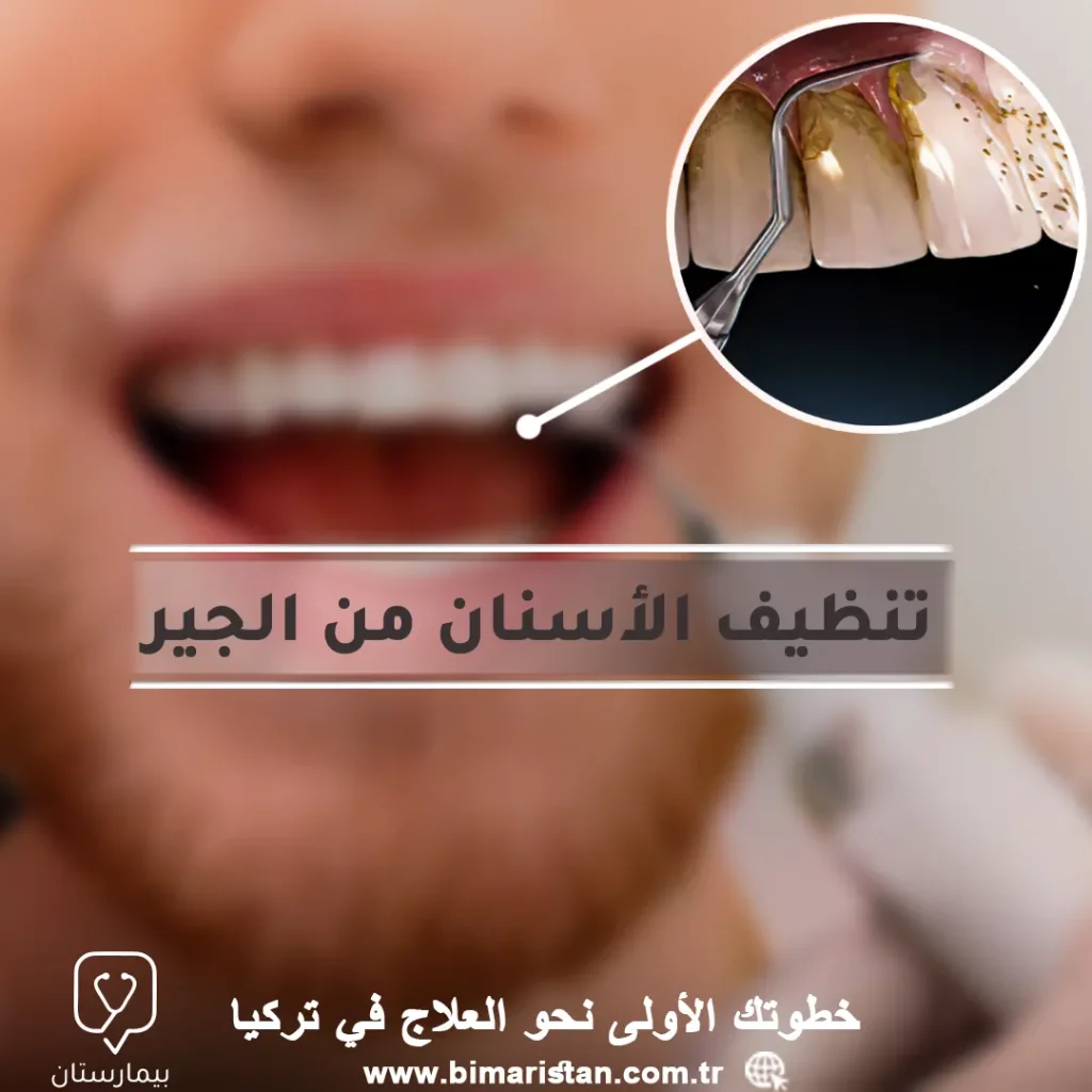 Türkiye'de diş ve diş etlerini tartardan temizleme