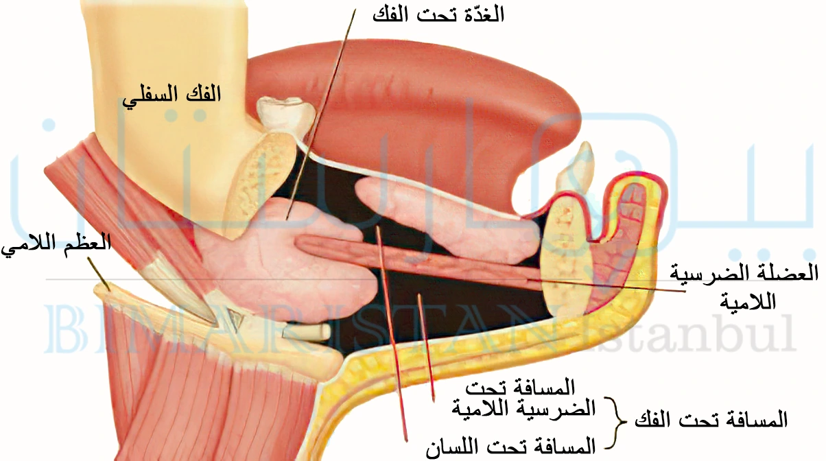 قد ينتشر إنتان الأسنان في المسافات الخلوية مما قد يسبب الإصابة بذبحة لودفيغ الخطيرة