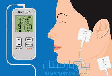 TENS . transcutaneous electrical nerve stimulation