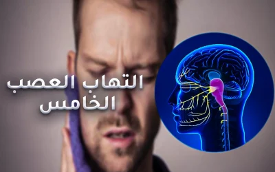 Fifth neuralgia: its causes and treatment in Turkey