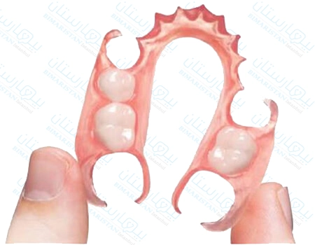 nylon dentures