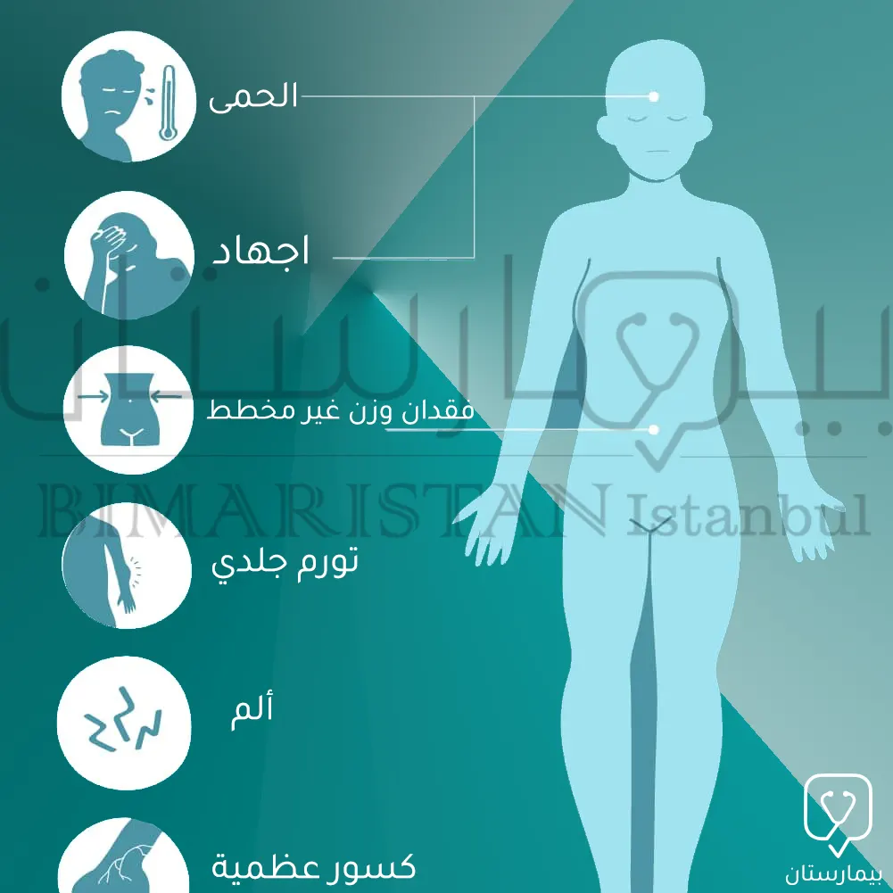 Diagram showing the main symptoms of bone cancer