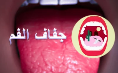 Dry mouth causes and treatment