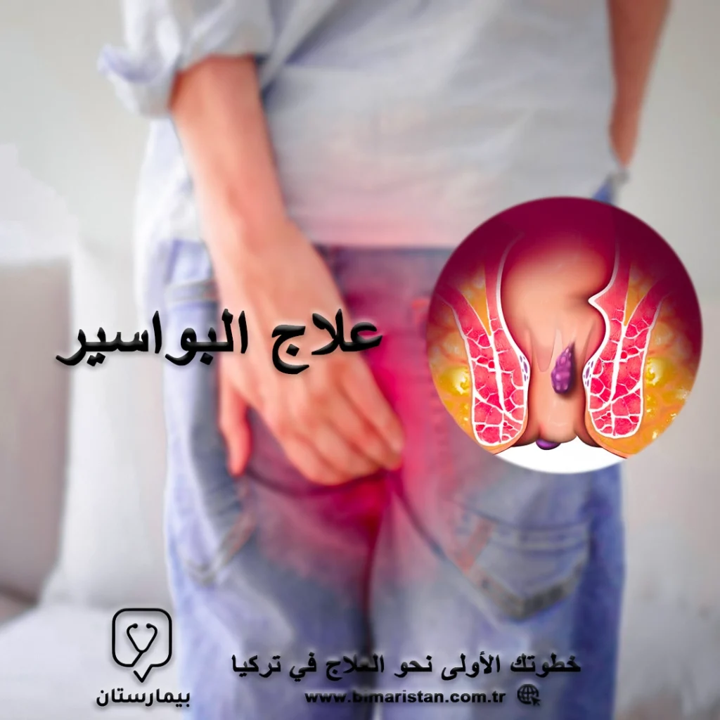All you need to know about hemorrhoids treatment in Turkey