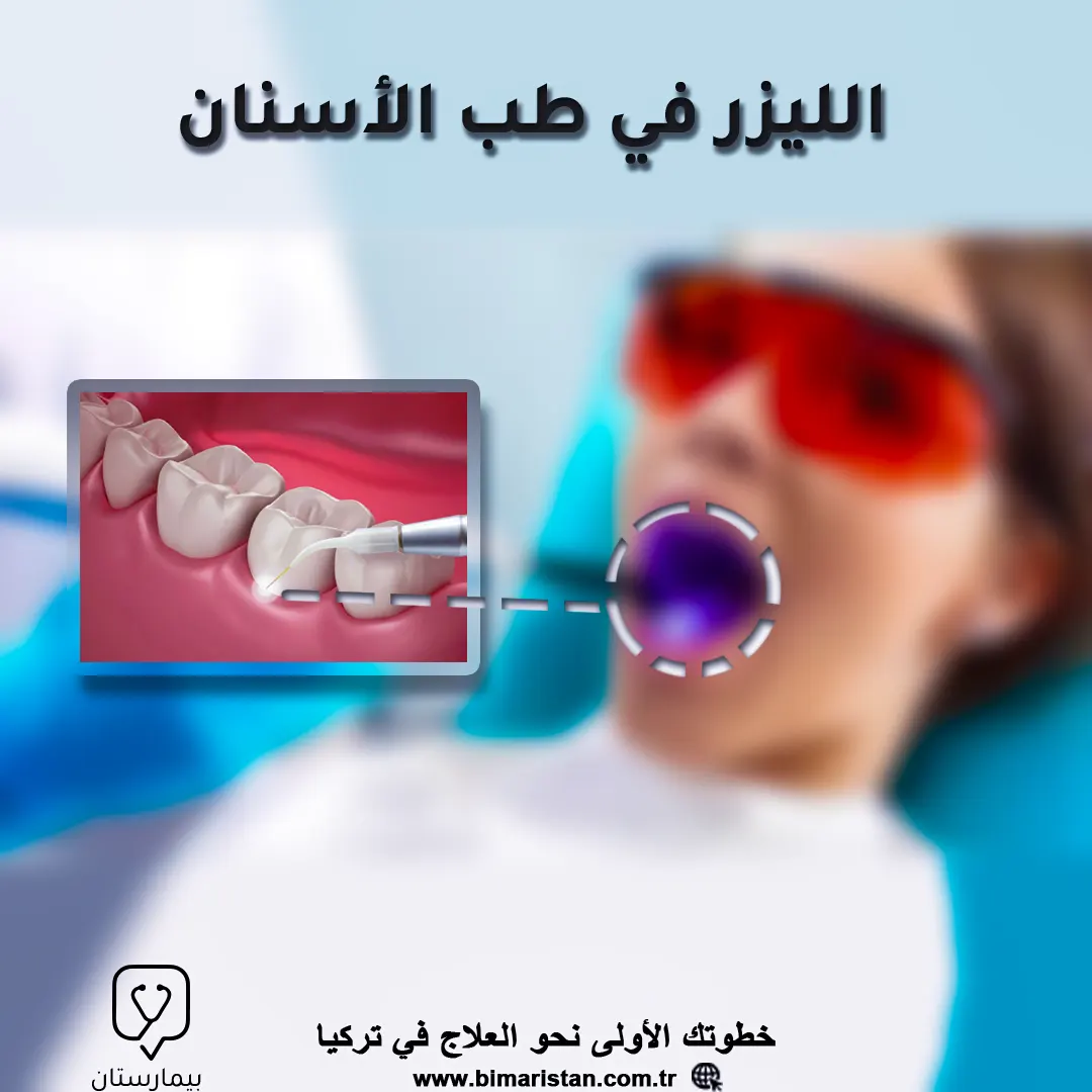 طرق علاج الأسنان بالليزر في تركيا