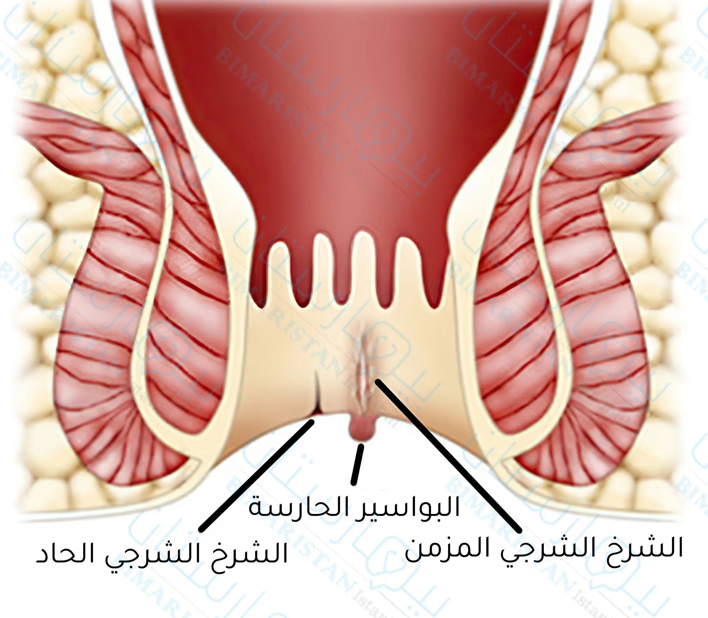 The difference between acute anal fissure and chronic anal fissure