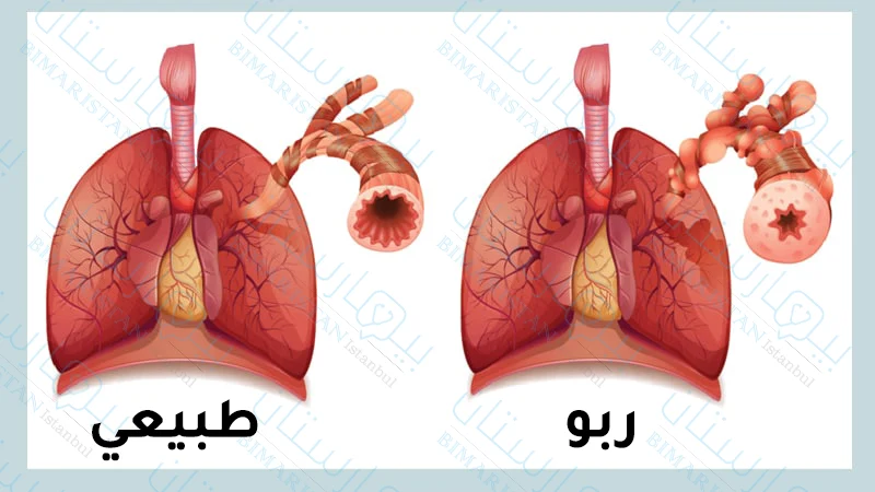 Comparison between bronchial asthma and the normal state