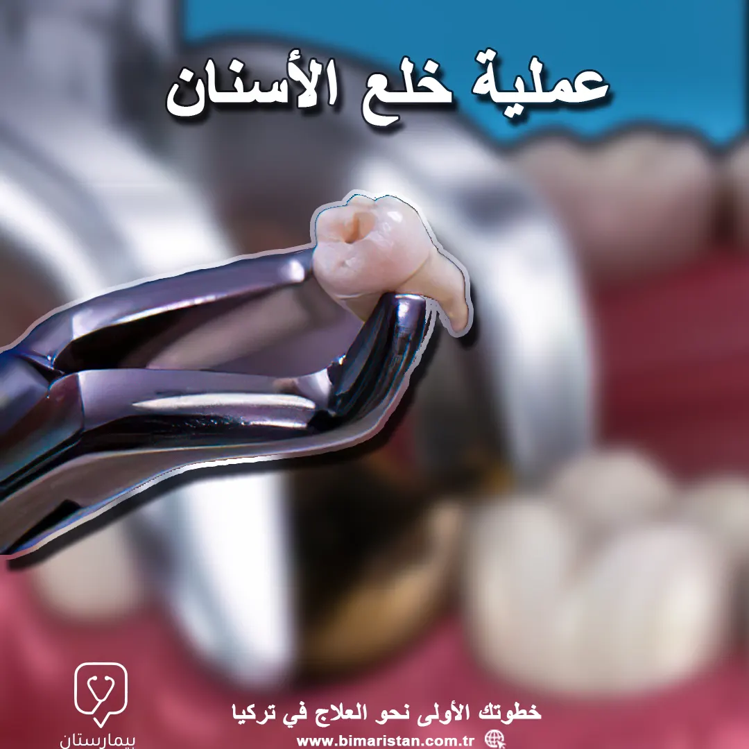 Tooth extraction in Turkey