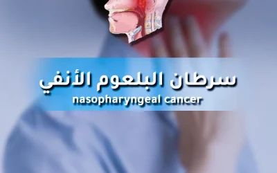 All you need to know about nasopharyngeal cancer and its treatment