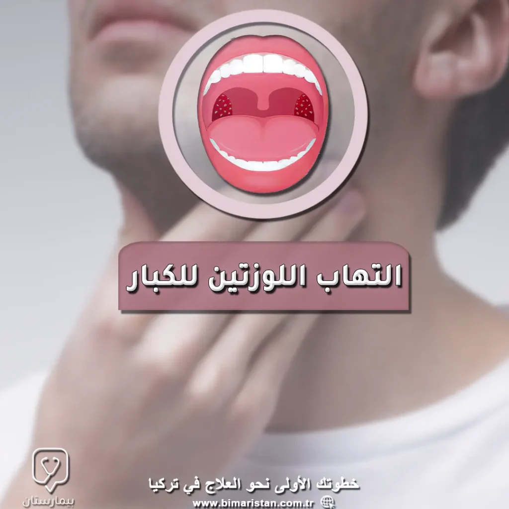 Symptoms of tonsillitis for adults and its treatment in Turkey