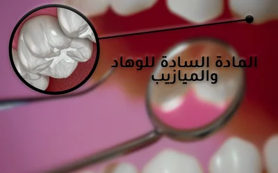 المادة السادة للوهاد والميازيب: للوقاية من نخور الأسنان