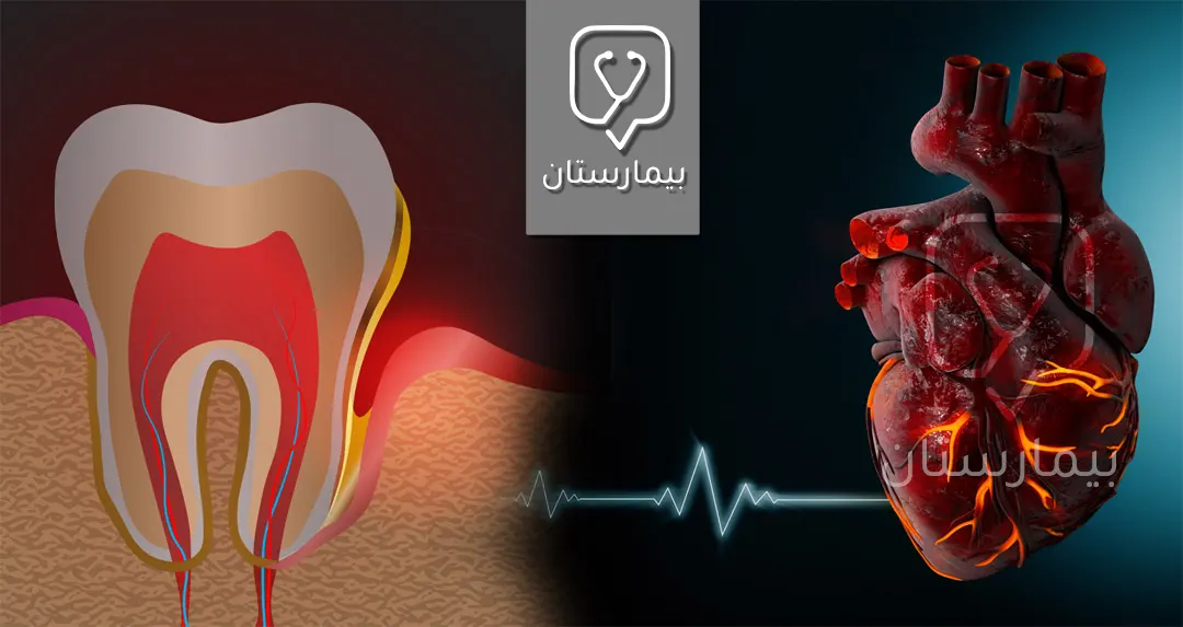 لصحة الفم والأسنان السيئة علاقة بحدوث الإصابة بأمراض القلب والأوعية الدموية