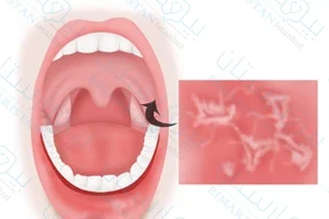red mouth lesions