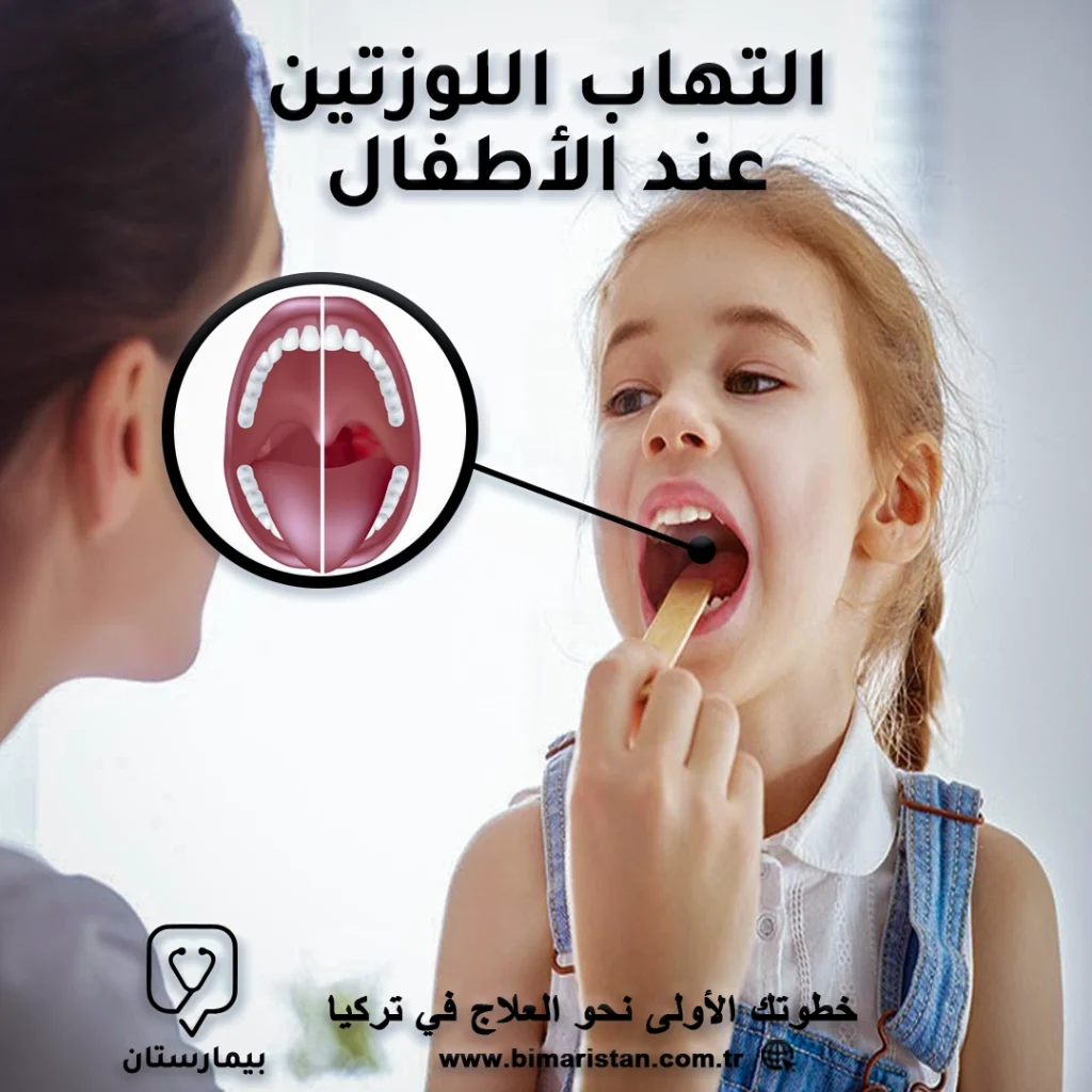 Symptoms of tonsillitis in children and its treatment in Turkey