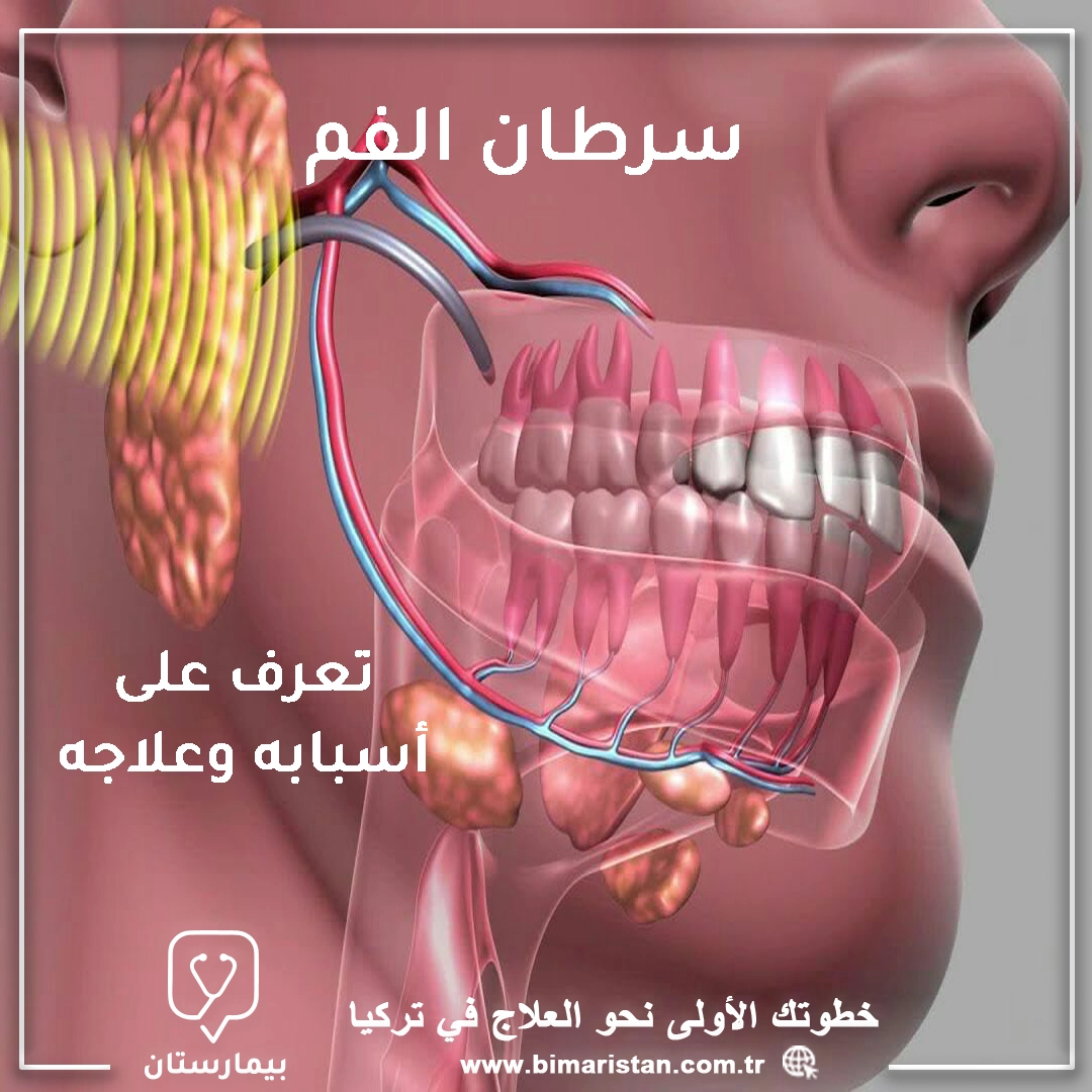 علاج-سرطان-الفم