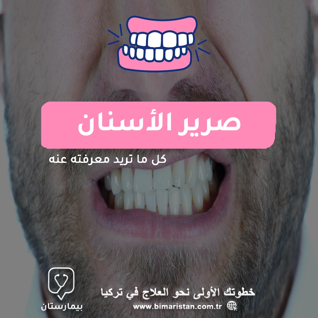 علاج-صرير-الأسنان