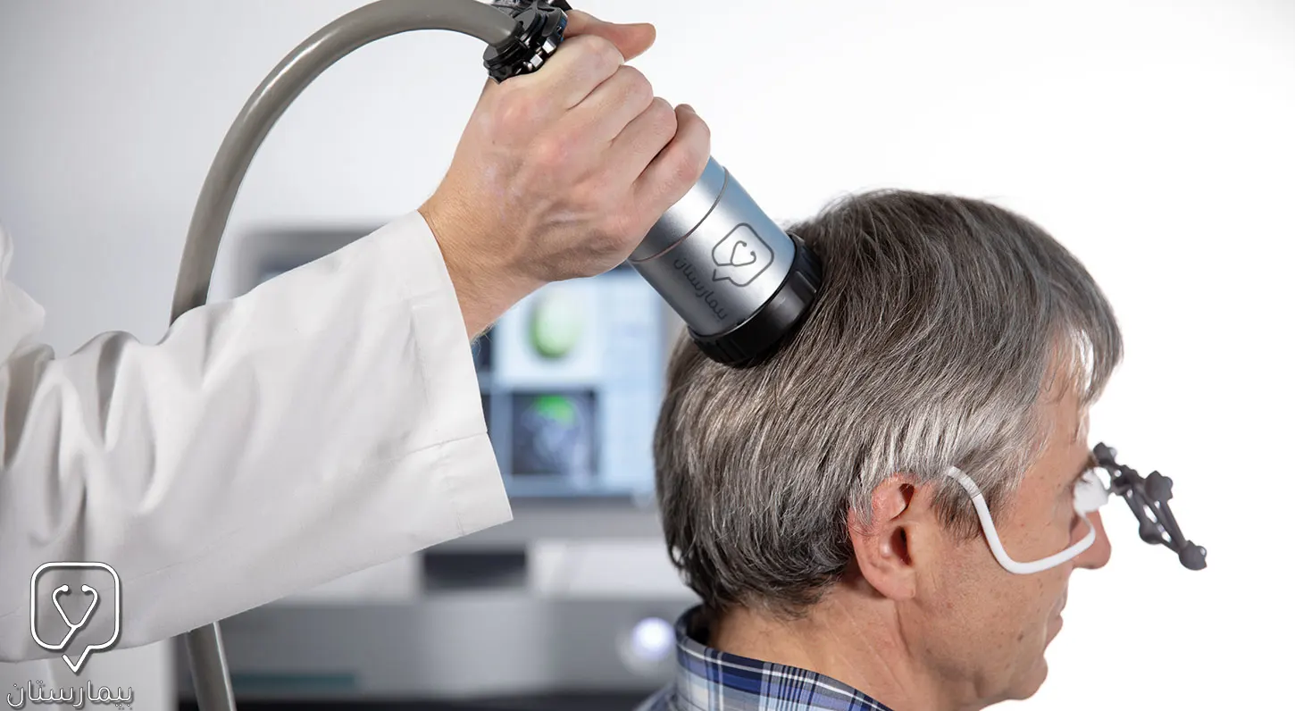 Treatment of Alzheimer's disease with transcranial pulse stimulation