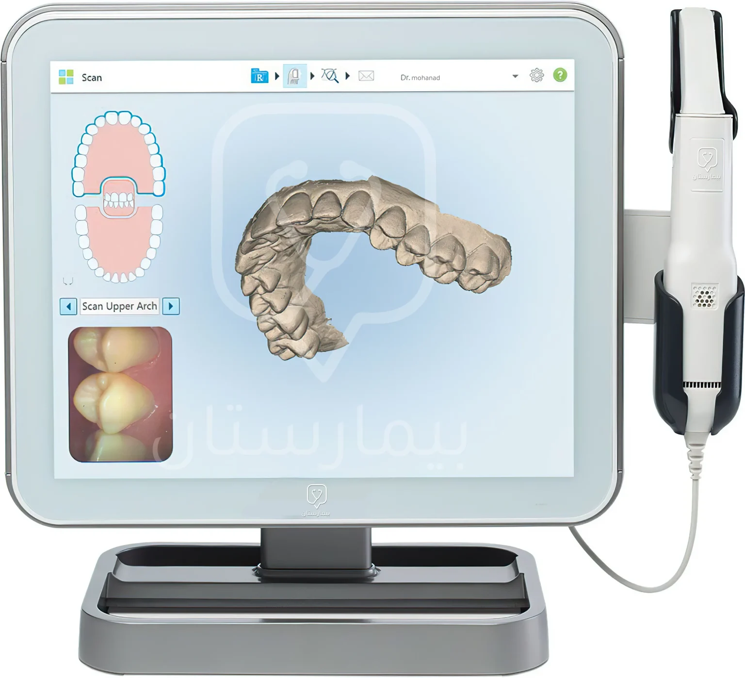 Скан под. ITERO сканер внутриротовой. Сканер ITERO Invisalign. Интраоральный 3d сканер. Внутриротовой 3d сканер 3ds.