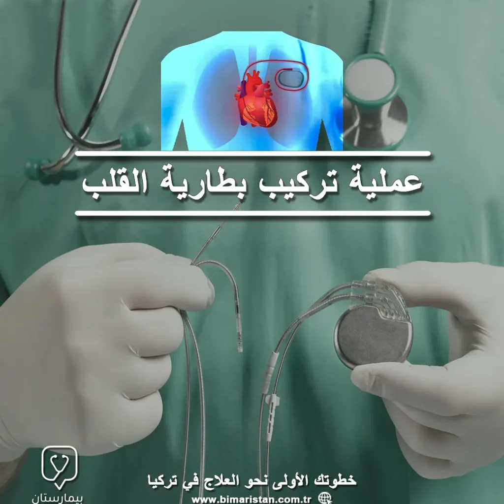 جميع تفاصيل عملية تركيب بطارية القلب في تركيا