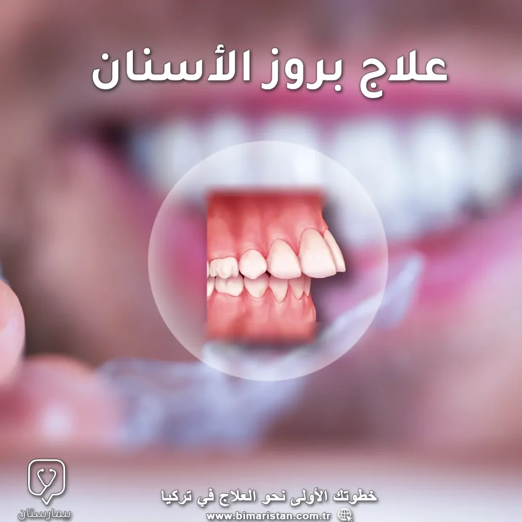 Türkiye'de diş sürme tedavisi