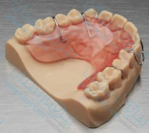 Ortodontik tedavi sonrası sabitleme cihazları