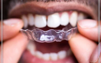 علاج ازدحام الأسنان بالتقويم الشفاف وخيارات التصحيح الأخرى