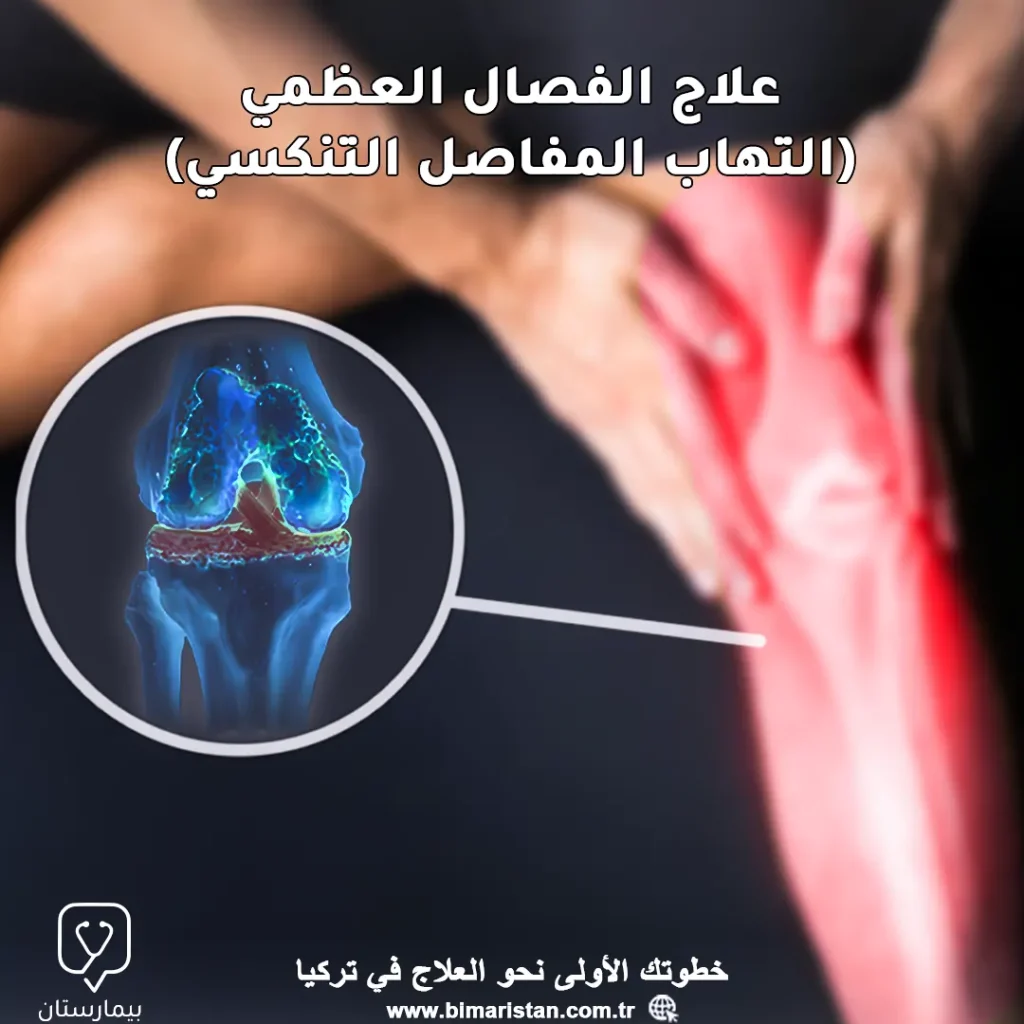 Osteoarthritis (degenerative arthritis) treatment in Turkey