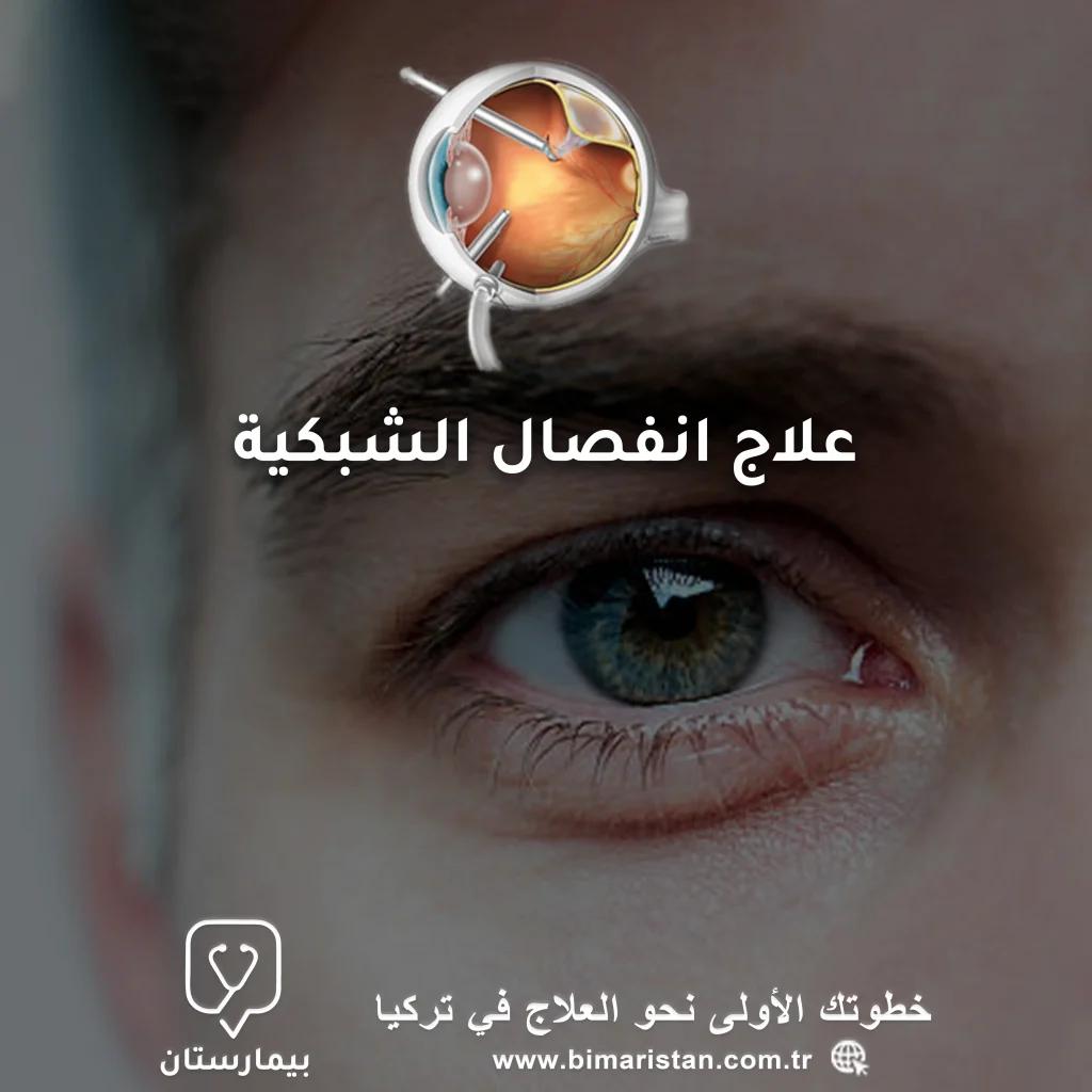 Cover image about retinal detachment