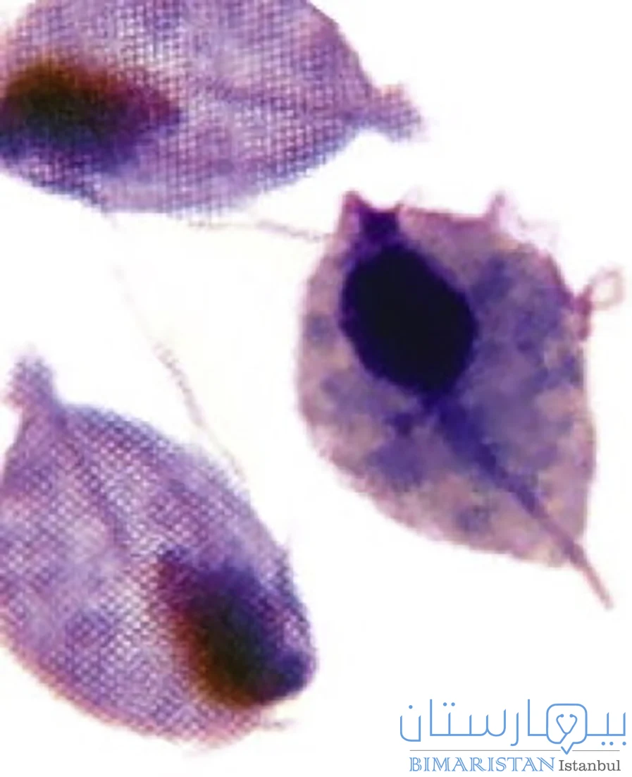 Trichomonas vaginalis'i mikroskop altında gösteren bir resim ve burada evli kadınlar için vajinite ihtiyacımız var