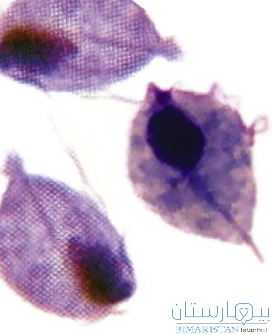 Ротовая трихомонада. Влагалищная трихомонада. Влагалищная трихомонада микроскопия. Люминесцентная микроскопия трихомонады.