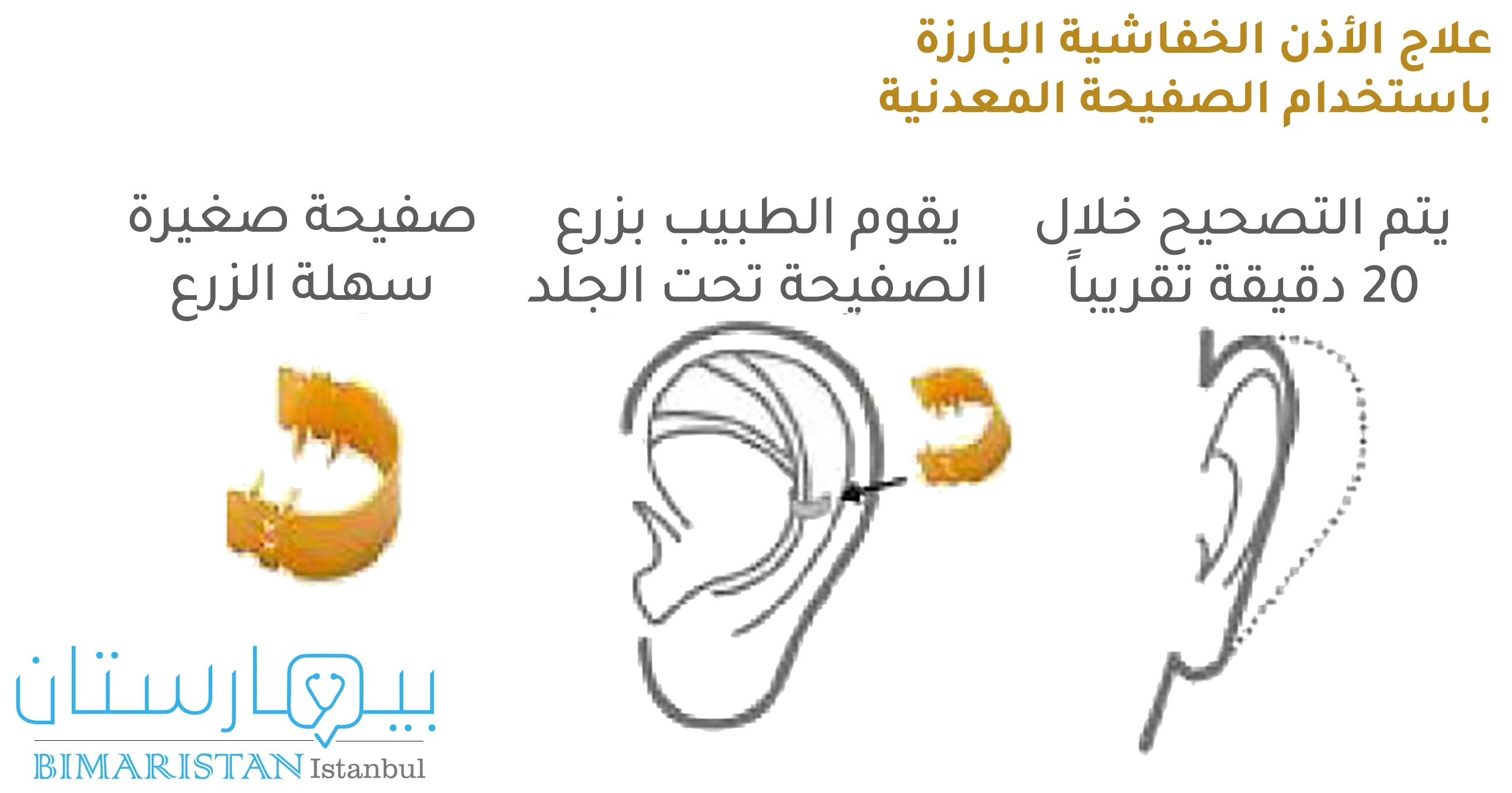 A picture showing the treatment of bat ear using a metal plate, the shape of the plate, and how it is placed on the ear