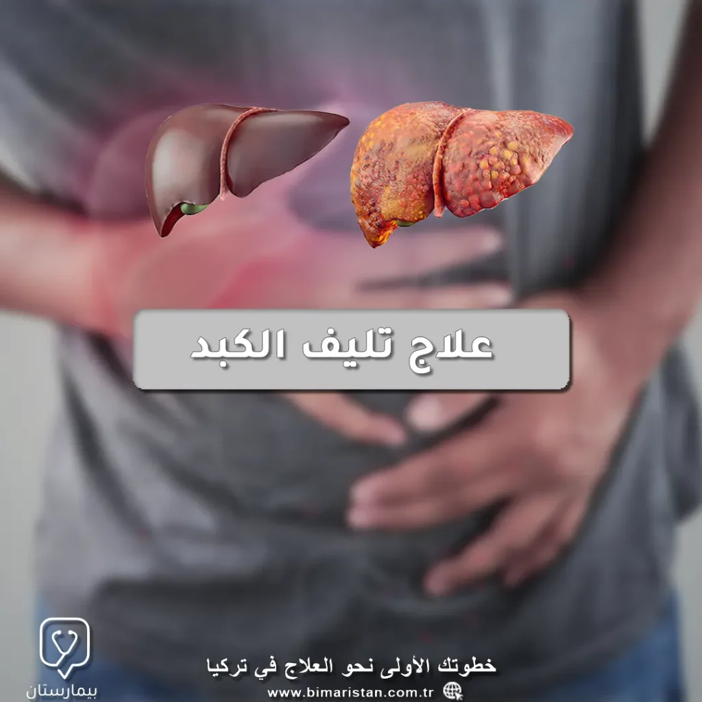 Cover image about the treatment of cirrhosis of the liver
