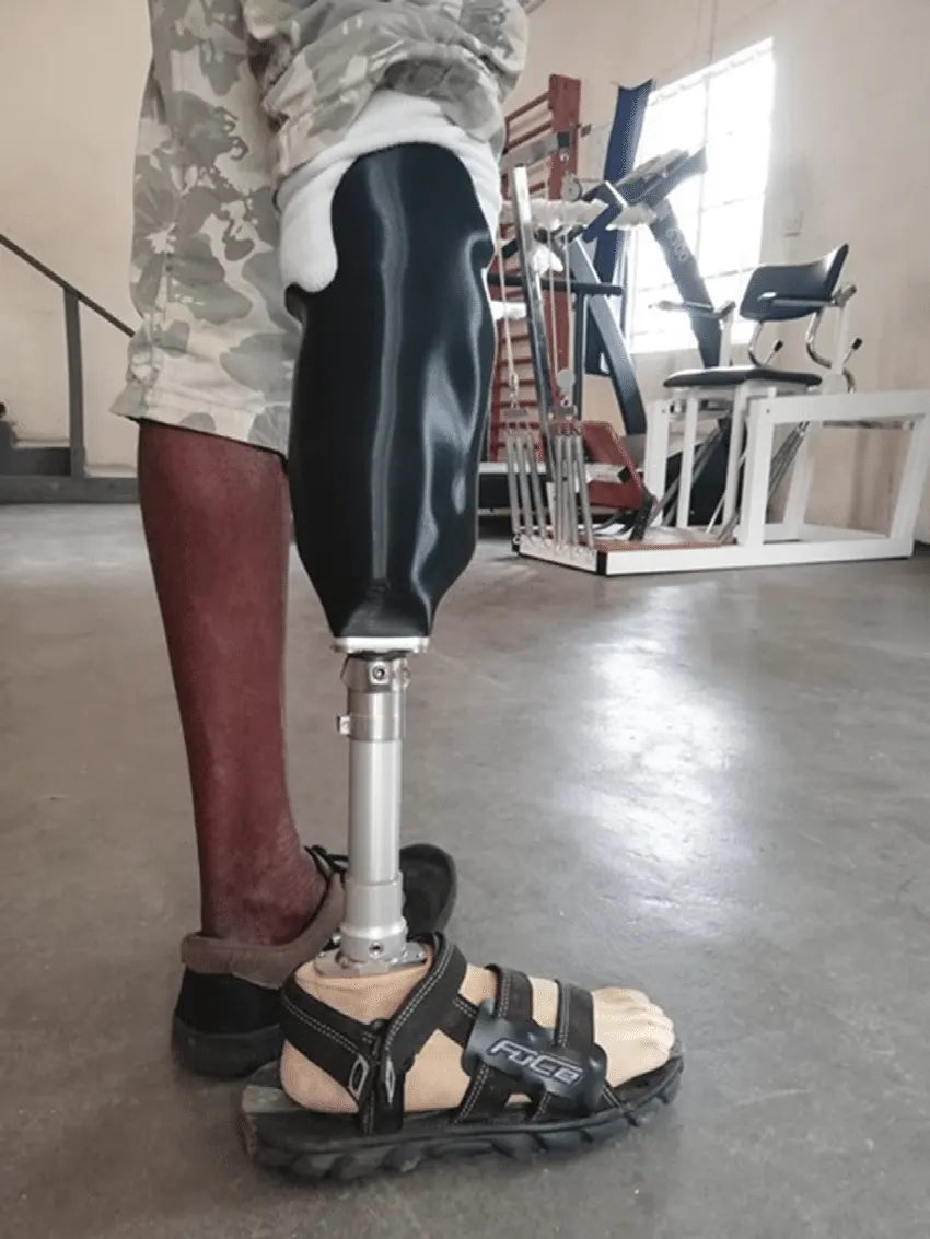 Picture showing a lower prosthesis used when installing lower prosthetics