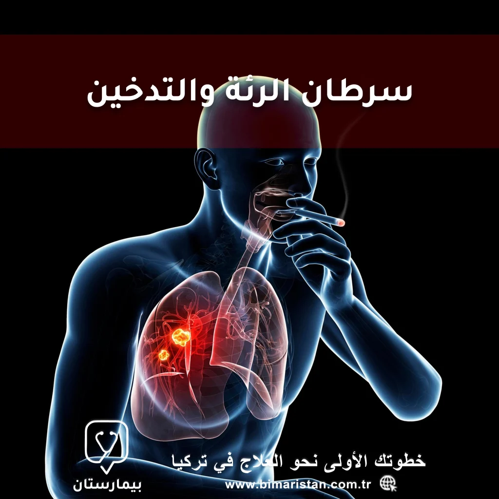 سرطان الرئة والتدخين | ما مدى الارتباط بينهما؟