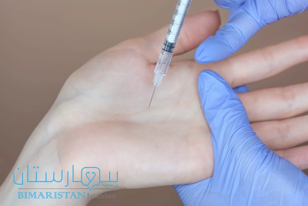 Botox injections in the palm of the hand to treat excessive sweating