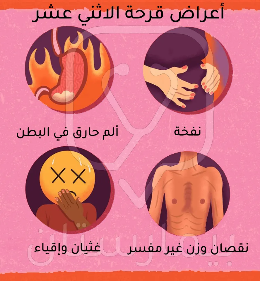 Duodenal ulcer symptoms
