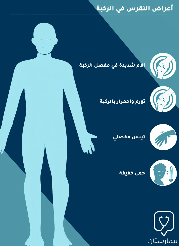 أعراض النقرس في الركبة