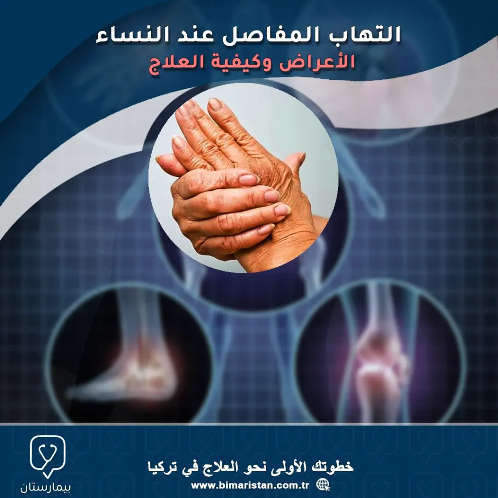 Symptoms of arthritis in women