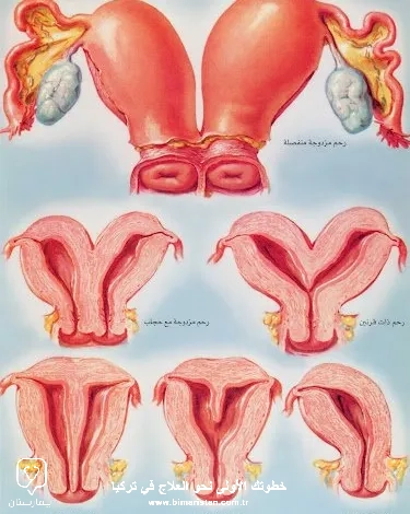 Congenital anomalies in the womb pictures