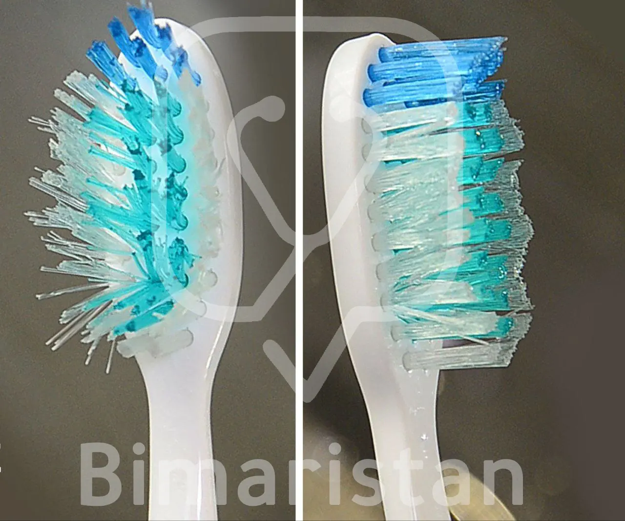 The photo on the left shows apparent damage to the toothbrush bristles and should therefore be replaced