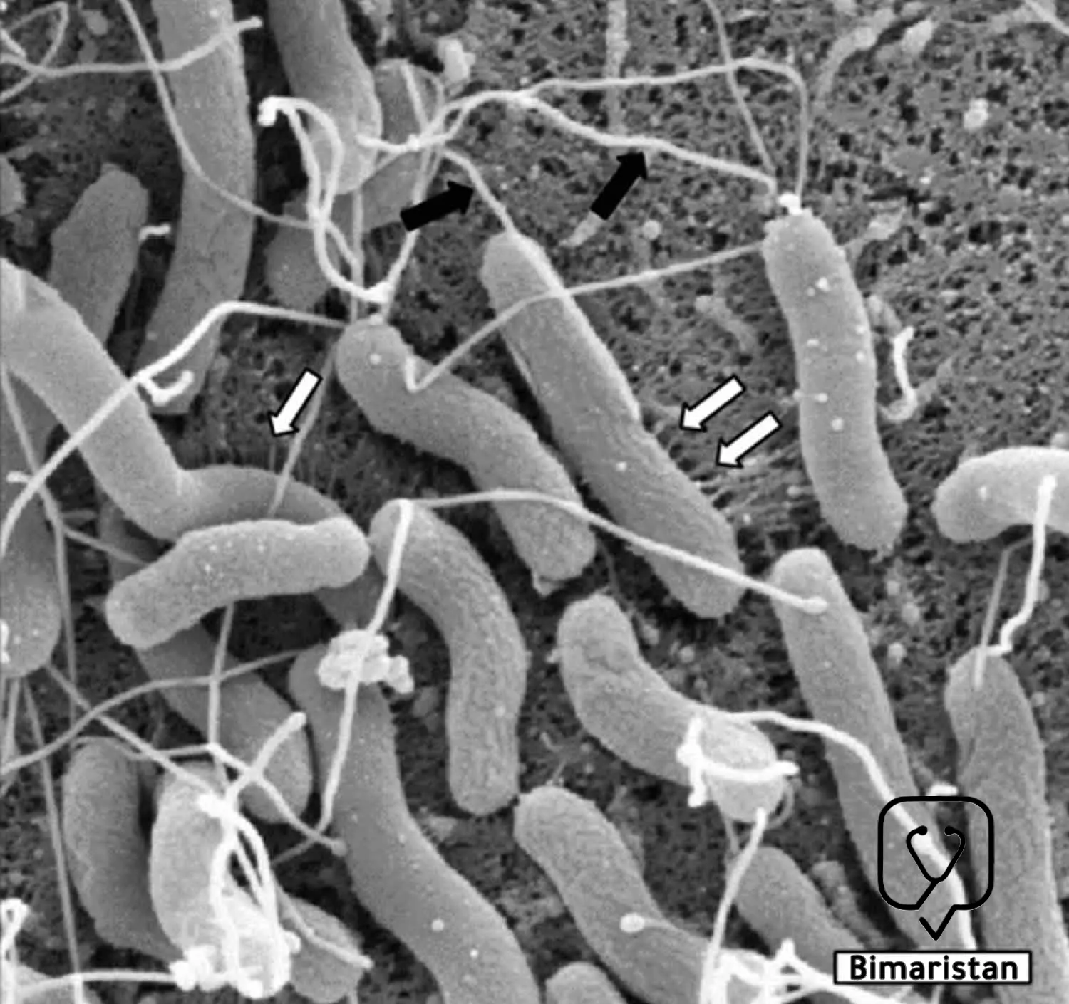 Electron microscope image of Helicobacter pylori